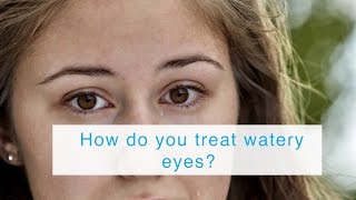 How do you treat watery eyes [upl. by Pru]