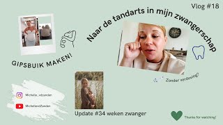 Naar de tandarts zonder verdoving  Update 34 weken Zwanger  Gipsbuik maken MichellevdZanden [upl. by Ahsatel]