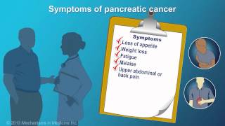 Pancreatic Cancer Signs Symptoms and Risk Factors [upl. by Eanal]