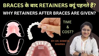 Retainers After Braces in Hindi Cost Time Why Retainers Are Important [upl. by Brnaba]