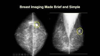 Introduction to Mammography  Radiology Basics  Ultrasound Imaging Technique [upl. by Aelhsa]