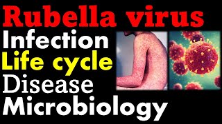 Rubella virus microbiology  infection pathology symptoms and replication cycle [upl. by Aiet]