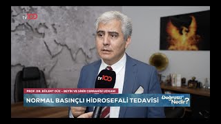 Normal basıncli hidrosefali BULENT DUZ [upl. by Bauer]