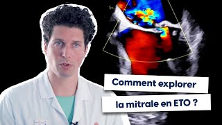 Comment explorer la mitrale en ETO [upl. by Eramal87]