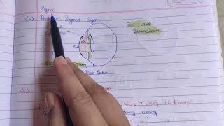 GlaucomaPART 1open angle glaucoma theory notes AK Khurana [upl. by Heidy25]