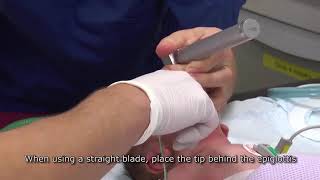 Neonatal intubation [upl. by Seaddon]