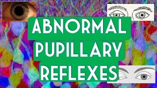 Abnormal pupillary reflexes [upl. by Cryan698]