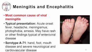 5 Enterovirus clinical manifestations including poliore [upl. by Noived]