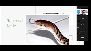 Snake Identification and Snake Bite Management [upl. by Clancy]