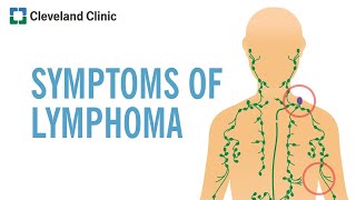 Warning Signs of Lymphoma [upl. by Queenie908]