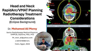 Head and Neck RapidArcVMAT Planning Radiotherapy Treatment Considerations [upl. by Nylorak833]