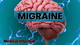 Migraine Headache Relief Migraine ka ilaj Migraine symptoms Migraine painMigraine [upl. by Eibrik]