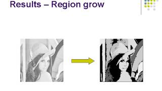 REGIONBASED IMAGE SEGMENTATION [upl. by Obediah]