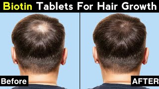 Biotin For Hair Growth  Biotin And Multivitamin Tablets For Hair Growth  Shorts [upl. by Harness]