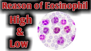 Reason of High Eosinophil  High Eosinophil causes [upl. by Halona]