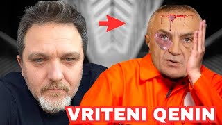 VRITENI QENIN  Jul Deda SULMON Ilir Meten pas Gjendjes se tij te Renduar ne Burg [upl. by Olaf154]