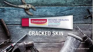 Top 5 uses of Elastoplast Wound Healing Ointment [upl. by Ahcsatan]