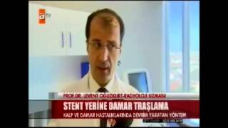 Damar tıkanmasında damar tıraşlama tedavisi [upl. by Adnohser]