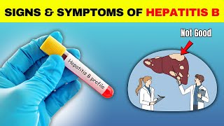 Signs and Symptoms of Hepatitis B HBV  Health Tips [upl. by Afira]