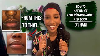 How To Get Rid Of Hyperpigmentation  Dr Hani [upl. by Puri]