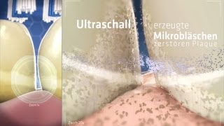 So funktioniert die Zahnreinigung mit echtem Ultraschall  emmident [upl. by Ralyat]