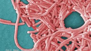 Legionnaires Disease What You Need to Know [upl. by Granny228]