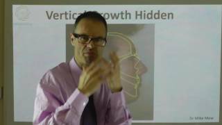 Hiding An Increase in Vertical Facial Growth By Dr Mike Mew [upl. by Benia428]