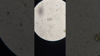 Hookworm egg in dogsAncylostoma caninum parasite dogs worms [upl. by Morgun332]