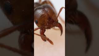 Fire ant bite and sting upclose [upl. by Placia]