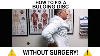 How to Fix a Bulging Disc NO SURGERY [upl. by Nnyltak]