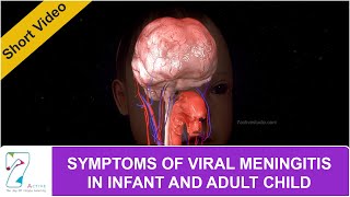 SYMPTOMS OF VIRAL MENINGITIS IN INFANT AND ADULT CHILD [upl. by Waal]