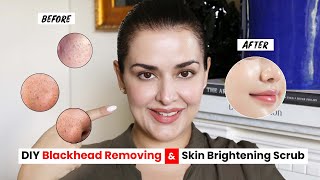 ULTIMATE DIY SCRUB TO GET RID OF BLACKHEADS I PORE CLEARING I SKIN BRIGHTENING [upl. by Artenek]