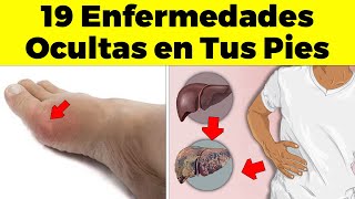 ¡ALERTA Descubre las 19 Señales de Enfermedad en Tus Pies [upl. by Ramey]