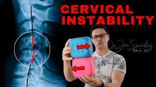 Cervical Instability What You Should Know  Dr Jon Saunders [upl. by Alil]