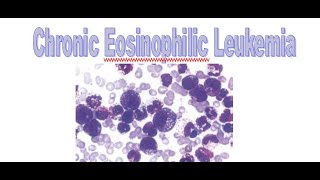 Chronic eosinophilic leukemia WHO 2022 [upl. by Wendie470]