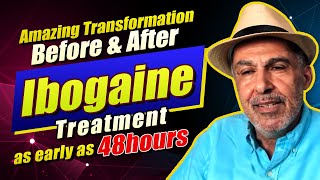 10 People Before and After Ibogaine Treatment [upl. by Lynna]