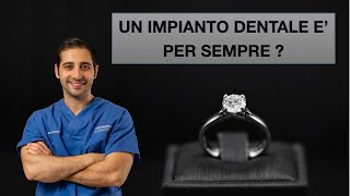 Quanto dura un impianto dentale [upl. by Refotsirk]