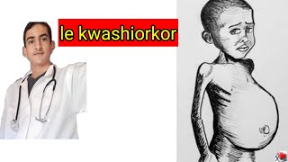 le kwashiorkor [upl. by Alboran513]