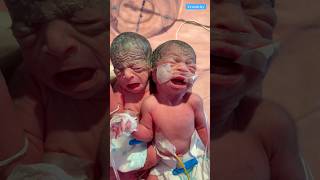 Newborn baby video medical viralvideo [upl. by Eppilihp285]