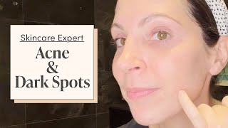 A Dermatologist amp Acne Specialists Nighttime Skincare Routine  Skincare Expert [upl. by Cira]