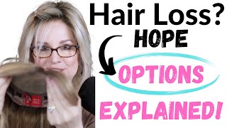 FEMALE HAIR LOSS  HOPE with HELPER HAIR TOP PIECES AND TOPPERS  YOUR THINNING HAIR OPTIONS [upl. by Garges295]