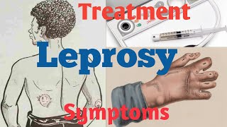 What is Leprosy  What causes Leprosy  Leprosy Diagnosis [upl. by Bergman]