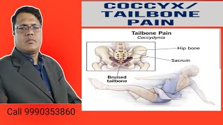 Tail Bone painCoccyx bone pain Cure in Neurotherapy Haldwani [upl. by Wattenberg]