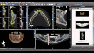 Blue Sky Plan Tutorial Images and Reports [upl. by Airres779]