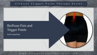 IlioPsoas Pain and Trigger Points [upl. by Rimhsak]