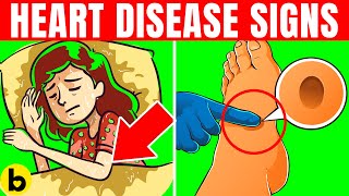 15 Early Warning Signs Of Heart Disease You Should Lookout For [upl. by Ahsekahs250]