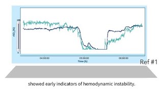 INVOS™ oximetry in the NICU Byte 11 NIRS as a guide to manage hemodynamic instability and shock [upl. by Schaffer]