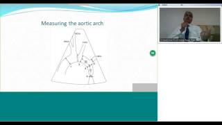 Diagnosis and Management of Coarctation of Aorta by Dr Suresh Kumar [upl. by Powel]