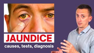 A Clinical Approach to Jaundice [upl. by Oicor]