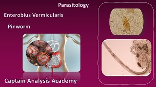 E4 parasitology Enterobius vermicularis الديدان الدبوسية [upl. by Menell932]